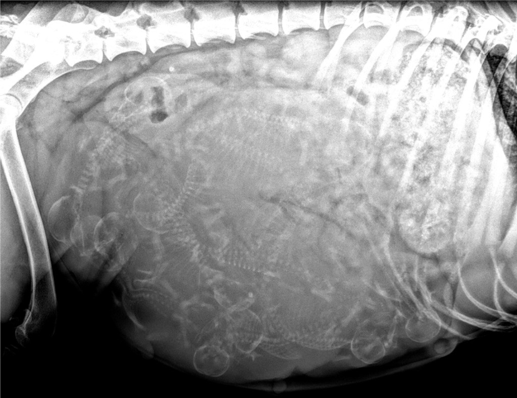 Radiographie